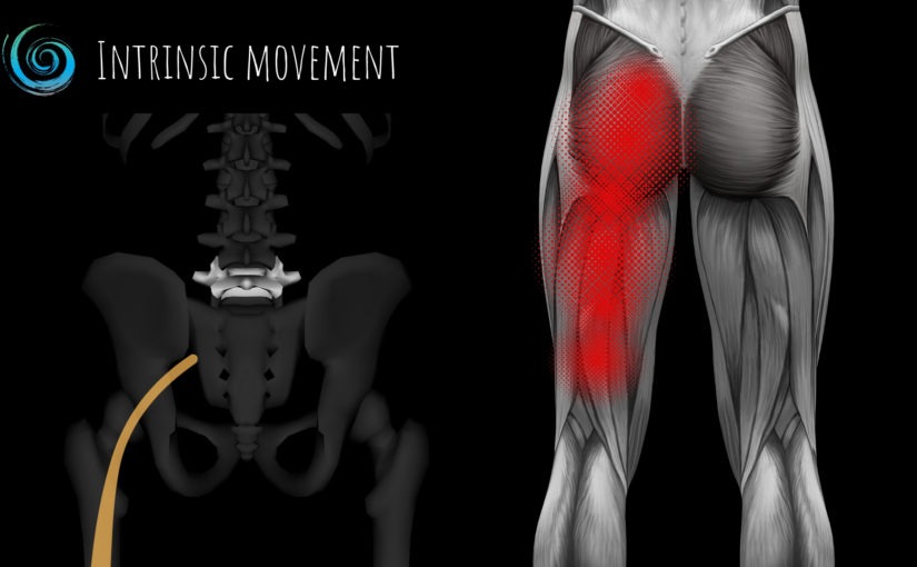 Sciatica